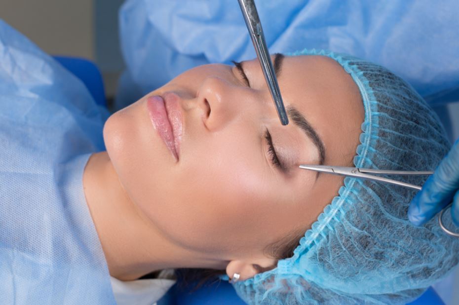 blepharoplasty
